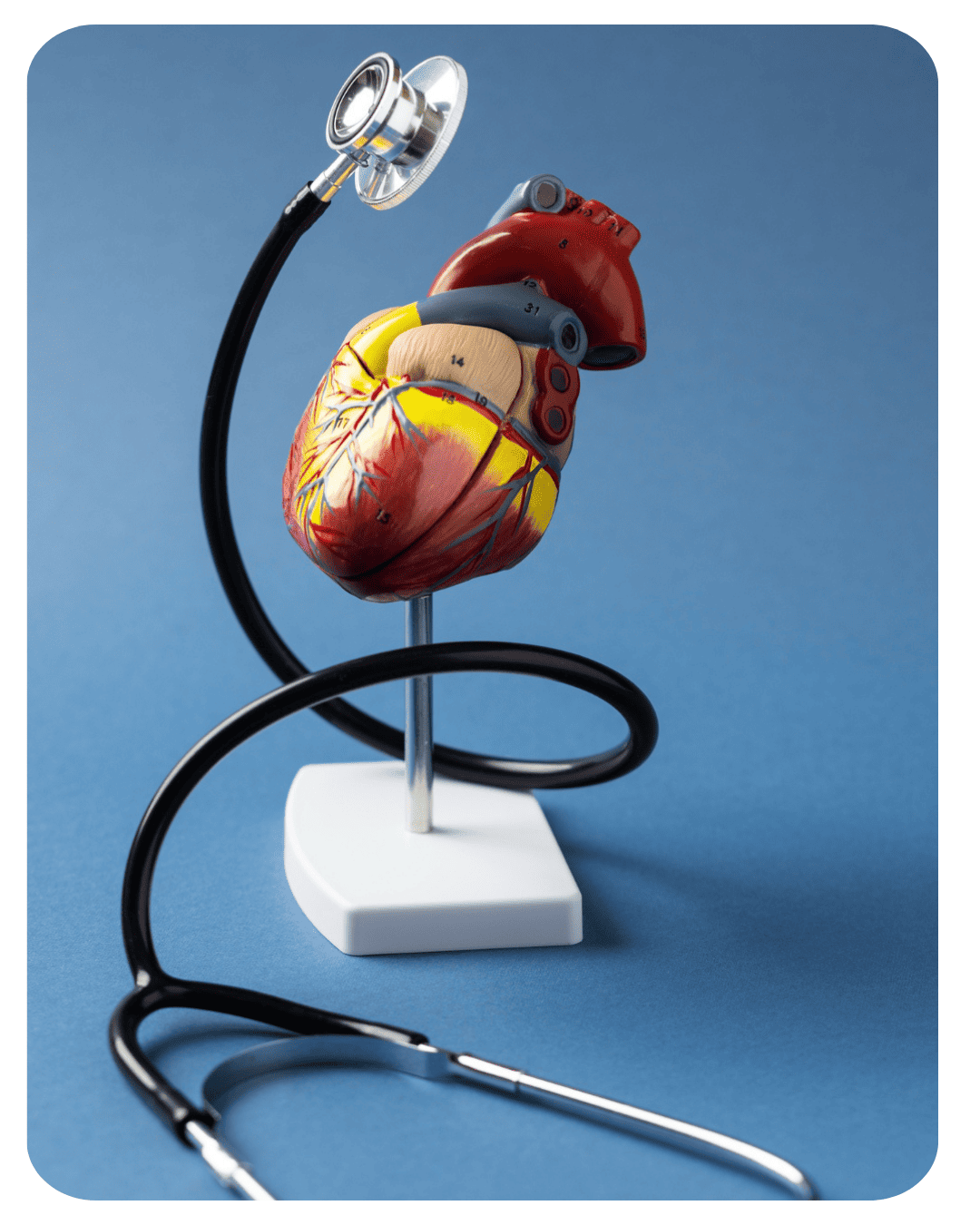 Preguntas frecuentes sobre cardiología intervencionista